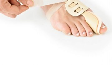 Hallux valgus splint - rechts - Neo G
