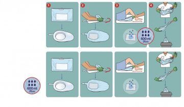 Hygiënische opvangzakken-Bedplan