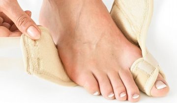 Hallux valgus soft support - rechts - Neo G